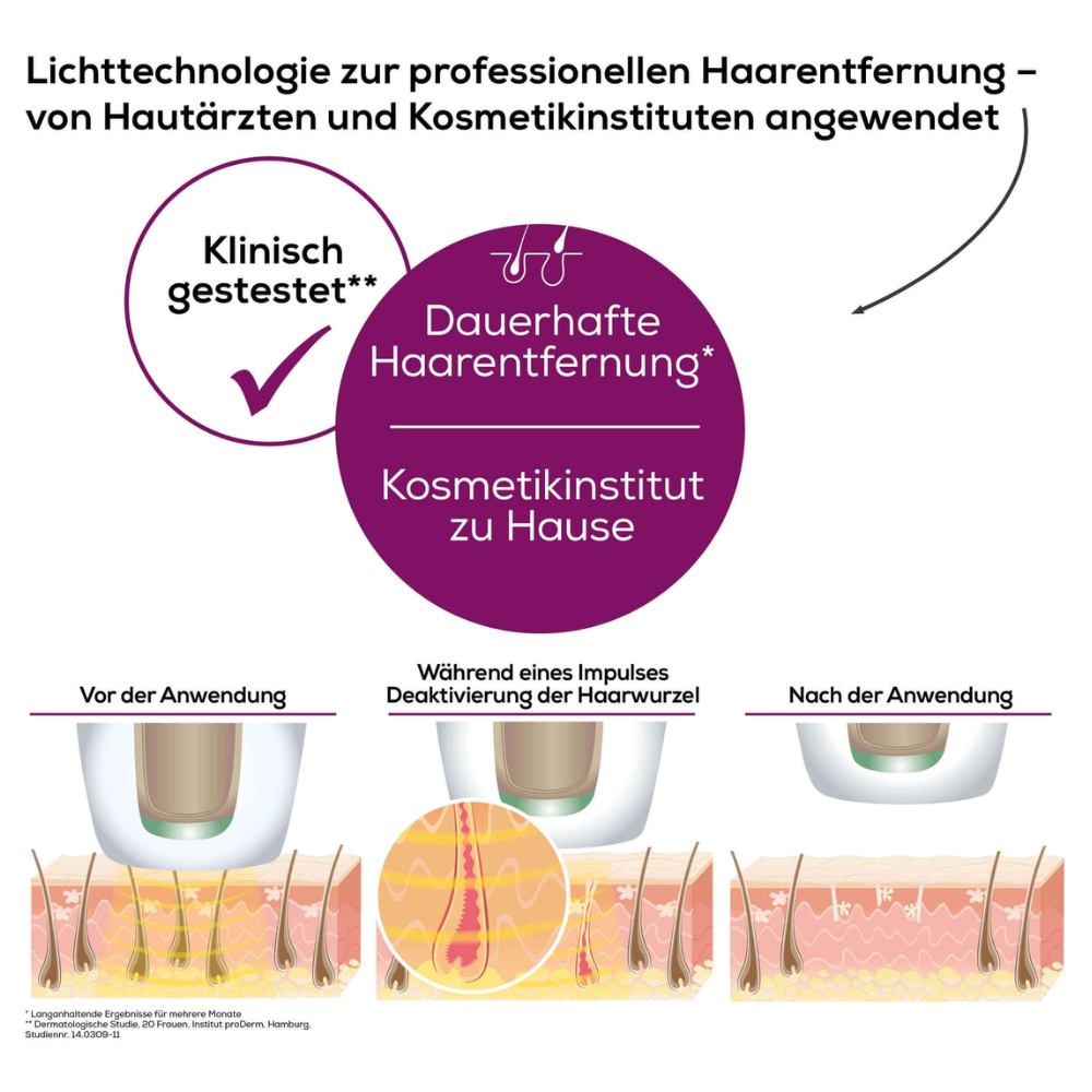 Eine deutsche Infografik zur Haarentfernungstechnologie mit der Beurer Dauerhafte Haarentfernung IPL VelvetSkinPro Black veranschaulicht den Vorgang vor, während und nach der Anwendung. Der Text betont die professionelle Dauerhafte Haarentfernung für den Heimgebrauch, getestet von Hautärzten und Kosmetikinstituten. Die Abbildungen zeigen die Haarentfernung.